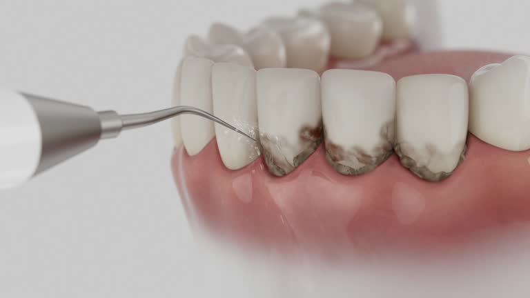 Reliable Invisalign Clear Aligners contractor in Calhoun County County, GA by Dentist Open Now